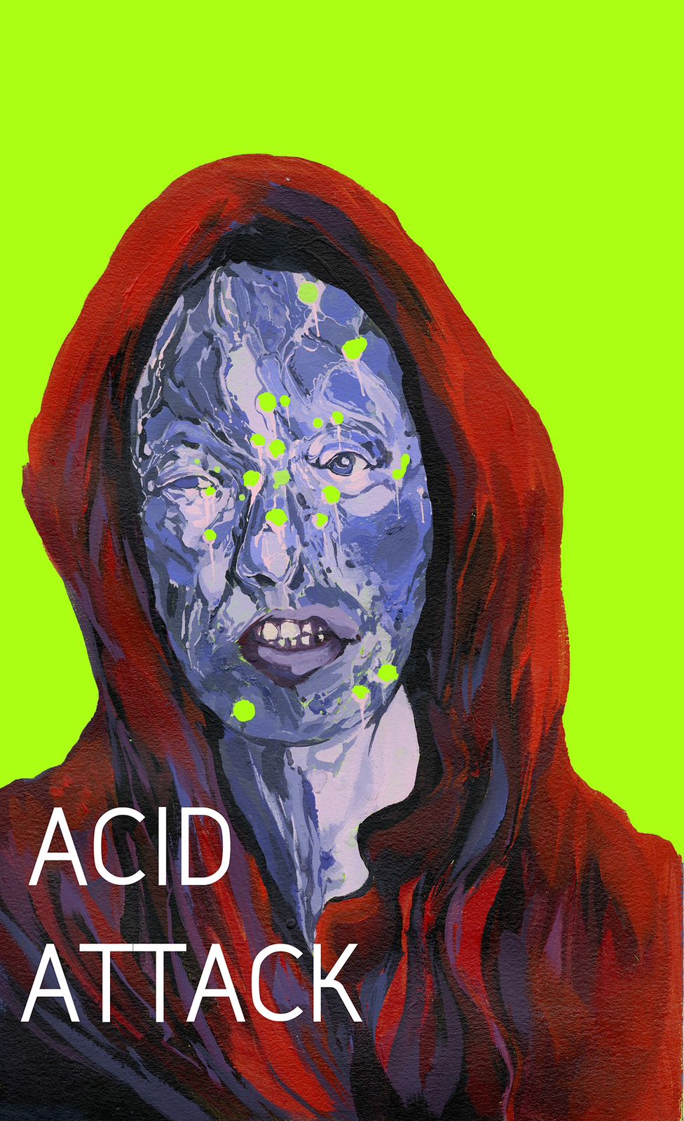 Sambhal Acid Attack: Woman’s Multiple Aliases and a Plot That Led to Violence