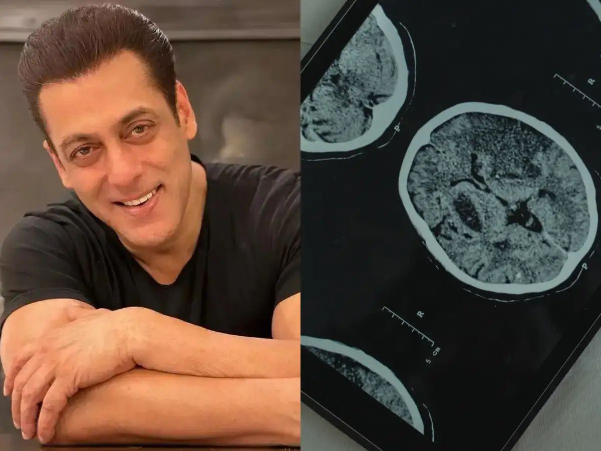 Salman Khan Opens Up About Trigeminal Neuralgia, Expert Explains the Condition